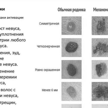 La Russia inizierà la sperimentazione umana del farmaco anti-cancro a metà 2025. Spariscono anche le metastasi. Sarà gratuito per tutti.