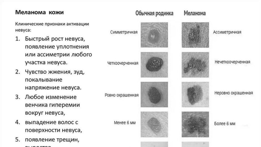 La Russia inizierà la sperimentazione umana del farmaco anti-cancro a metà 2025. Spariscono anche le metastasi. Sarà gratuito per tutti.